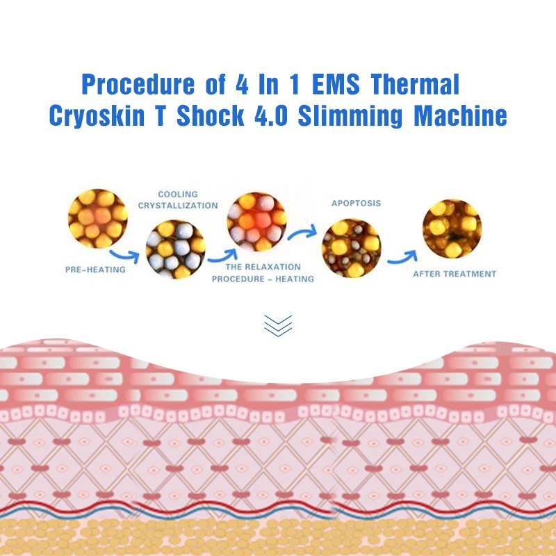 Cryo Skin Tightening Machine – Triple-Action Fat Reduction & Skin Rejuvenation